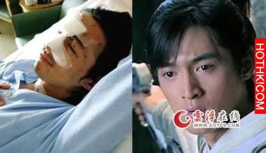 車禍後，「胡歌」縫了一百針，當聽到助理過世，他不能流淚怕汙染傷口，只能這樣表達悲 ...