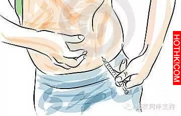 糖尿病友腳變成「焦炭」 ？怎麼防糖足，看這裡！