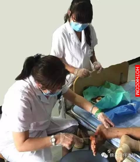 糖尿病友腳變成「焦炭」 ？怎麼防糖足，看這裡！