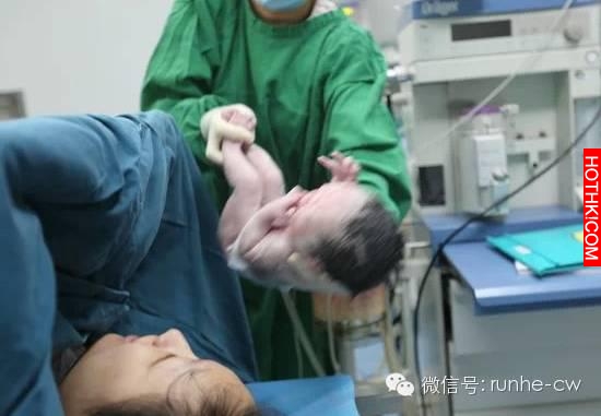 嬰兒竟拼命要從肛門鑽出來，驚魂一幕讓醫生護士徹底傻眼了！