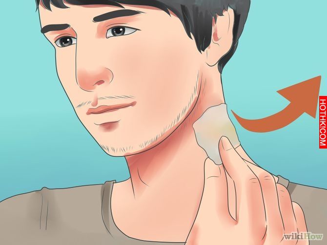 Remove an Ingrown Hair Step 15 Version 2.jpg