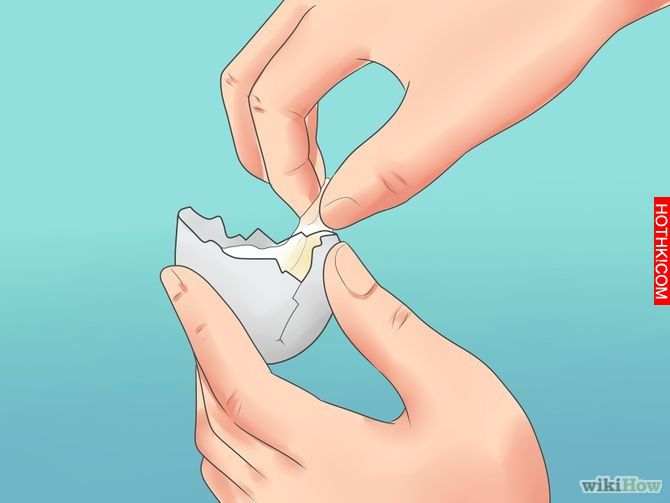 Remove an Ingrown Hair Step 12 Version 2.jpg