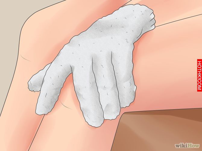 Remove an Ingrown Hair Step 1 Version 3.jpg