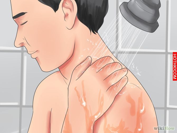 Remove an Ingrown Hair Step 16 Version 2.jpg
