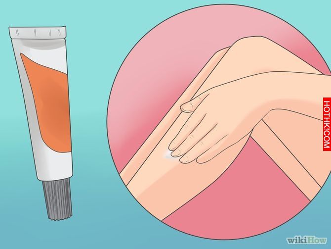 Remove an Ingrown Hair Step 3 Version 3.jpg