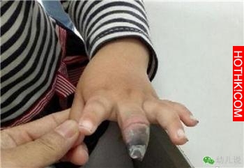 天氣冷不敢給新生兒洗澡10多天，正想洗澡打開紙尿褲媽媽被嚇慘