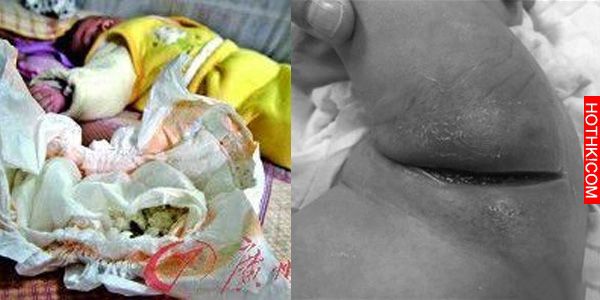 天氣太冷10幾天不敢幫寶寶洗澡！正想幫寶寶洗澡時，打開紙尿褲媽媽當場被嚇慘！寶寶竟 ...