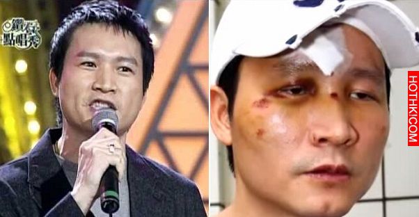 還記得當年紅透半天邊的「劉文聰」秦楊嗎？如今他欠債千萬...遭人圍毆...過著淒苦的生 ...