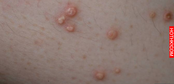 身體長「這東西」真的太可怕，一定要好好排毒！千萬記住「這毒素」一定要趕緊排除身體 ...