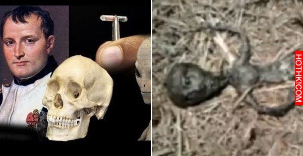 「拿破崙」身分不單純，考古學者在他的頭蓋骨裡發現「這種東西」...公佈會震撼全世界 ...