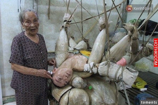 獨子腦癱47年！86歲老母親無奈哀傷！當說明將他懸掛的原因時……見者無不落淚！ ...