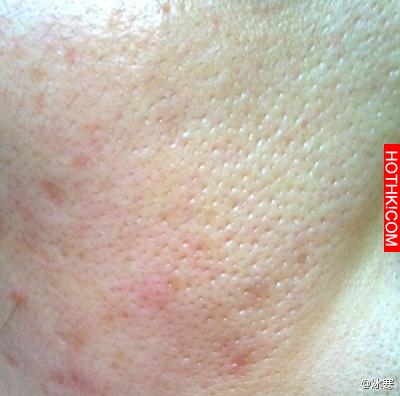 有這方法70歲毛孔不粗大 不長皺紋不顯老