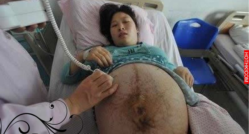 實拍四胞胎懷孕過程！超大的肚子太令人震驚了！！沒想到生出來的那刻肚子竟然… ...