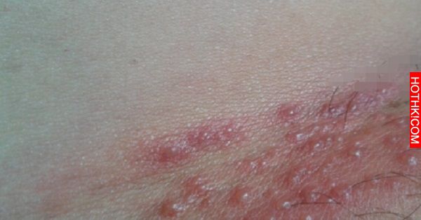 她的私密處長了「這種東西」，婦產科醫生看了也嚇呆...處理的時候竟然這麼做... ...