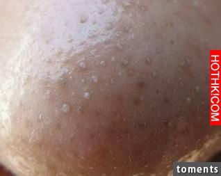 4大招讓黑頭永遠消失！毛孔變小了！粉刺痘痘通通不見了！太棒了一定要學起來！