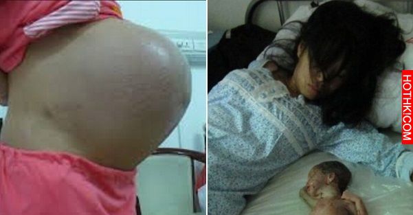 孕婦滿肚子都是血，胎兒從子宮溜出，只因為她做了以為很正常的行為...卻是殺了一條生 ...