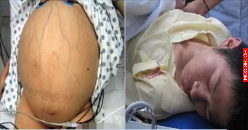 孕婦肚痛要生！進產房不到三分鐘，小孩竟啪啦啪啦生下來了！爸爸問：「我的孩子呢？」 ...