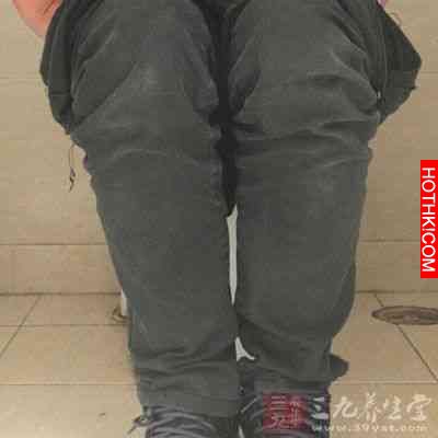做完這一事90後辣媽竟成禿子
