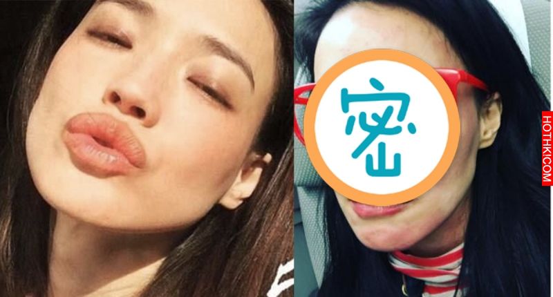 女神舒淇素顏上陣太嚇人了！因為他臉居然變得慘不忍睹...長這些東西是什麼啦！ ...