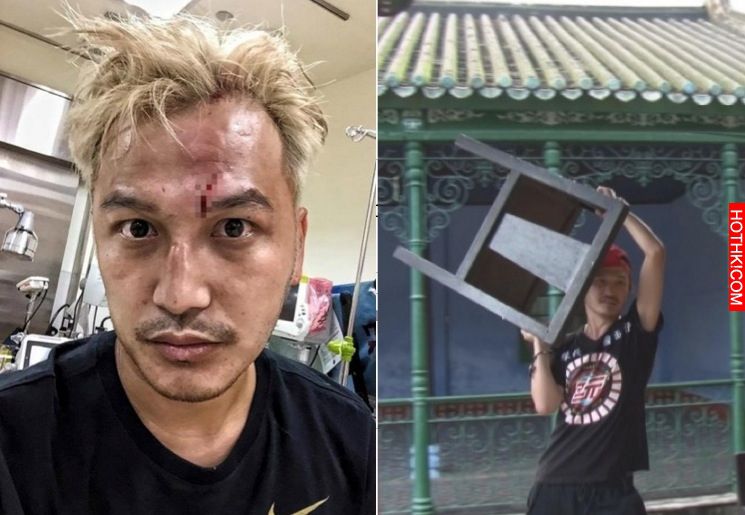 出事了！Kid 緊送急診就醫，一到醫院Kid求醫生『快救我...』醫生大傻眼：「你做了什麼 ...