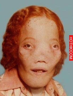 臉部畸形男孩從小被霸凌，有醫生要替他整形時，他的回答讓人詫異