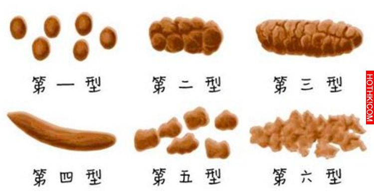 上完廁所後「留1秒觀察大便」就能讀出人體隱藏的健康訊息，出現這些形狀跟顏色就代表 ...