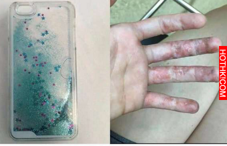 如果你正在用著圖片裡的這款「液體手機殼」，請你在嚴重傷害還未造成前立刻把它丟掉！ ...