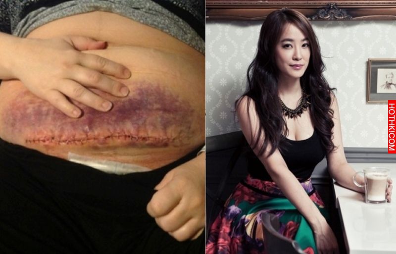 去年未婚先孕的王以路剖腹產愛女，頭卻整整卡了20分鐘拉不出來！連醫生都沒遇過，最後 ...