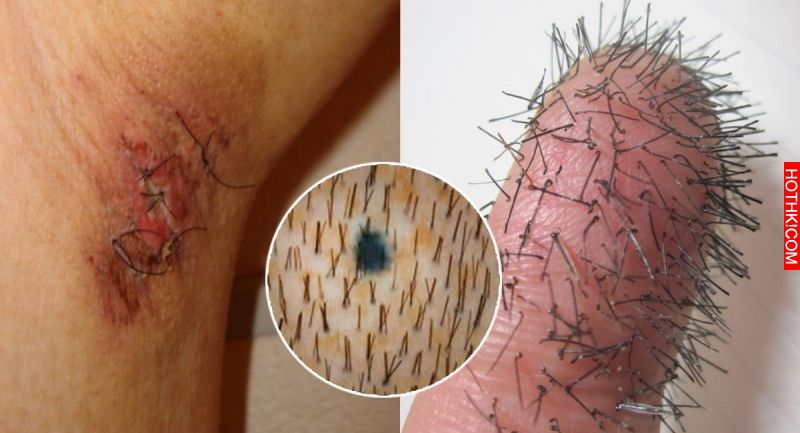 經常「拔腋毛」的人都嚇到了！竟然會....完全不敢相信阿！！ ...