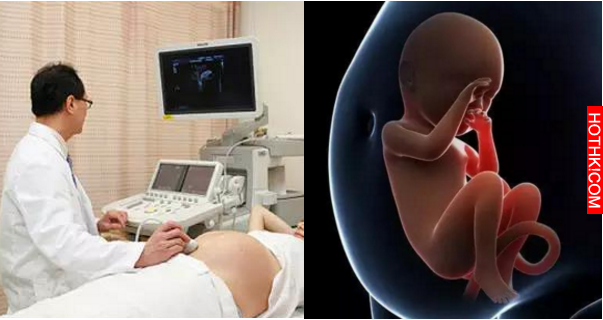 為了生兒子，她第三次剖腹產，打開肚子時醫生和護士都被嚇呆了… ...
