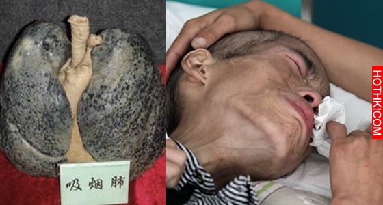 超恐怖! 日本研究報告「比吸菸致癌性更強」的食物竟是它?! 糟糕了，我時常吃到.... ...