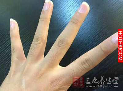小指長度超過它一生不愁吃穿