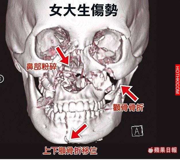 服務生將頭伸進菜梯,下一秒竟發生可怕慘劇!餐廳不顧她的死活居然叫她做這件事!她決 ... 服務生將頭伸進菜梯,下一秒竟發生可怕慘劇!餐廳不顧她的死活居然叫她做這件事!她決 ...
