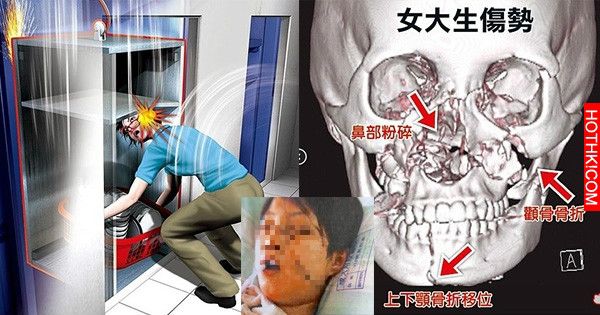 服務生將頭伸進菜梯，下一秒竟發生可怕慘劇！餐廳不顧她的死活居然叫她做這件事！她決 ...