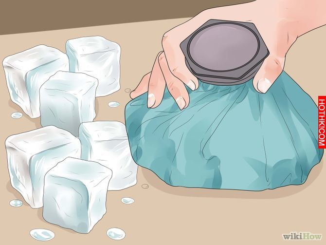 Get Rid of Hemorrhoids Naturally Step 6.jpg