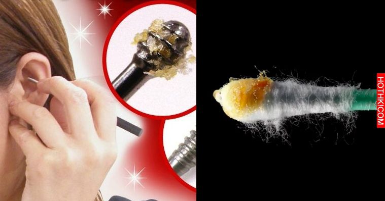 太可怕了！耳屎原來是...喜歡挖耳朵的人一定要看！看完你還敢亂挖嗎？ ...