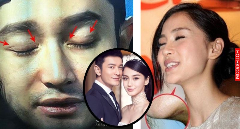 驚！明星不承認整容，這些疤痕怎麼解釋？但最後一張讓我流淚了… ...