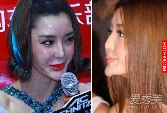 明星不承認整容 這些疤痕怎麼解釋？