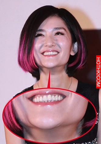 明星不承認整容 這些疤痕怎麼解釋？