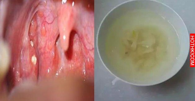 超猛！昨天喝了一碗「這個」，立馬鼻塞通了喉嚨不痛了！神級撇步讓你秒甩感冒糾纏！ ...