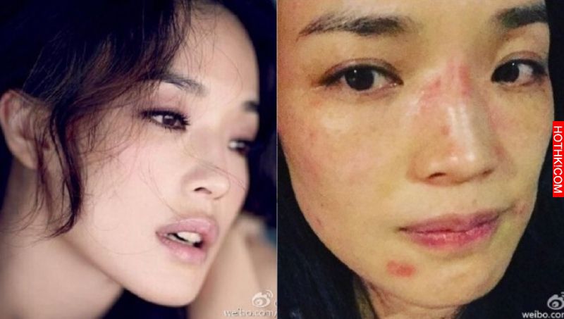 舒淇分手了？她淚PO文曬「毀容照」嚇壞眾人！沒想到好友小S「一句話」竟被酸：「其實 ...
