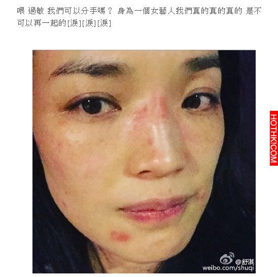 舒淇分手了？她淚PO文曬「毀容照」嚇壞眾人！沒想到好友小S「一句話」竟被酸：「其實 ...