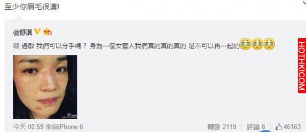 舒淇分手了？她淚PO文曬「毀容照」嚇壞眾人！沒想到好友小S「一句話」竟被酸：「其實 ...