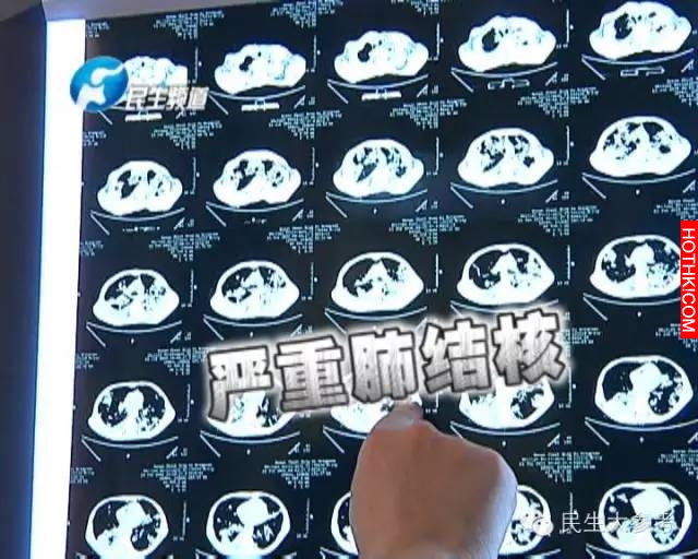震驚！20歲年輕人的肺全部爛掉！只因連續7年一直去這個地方..... ...