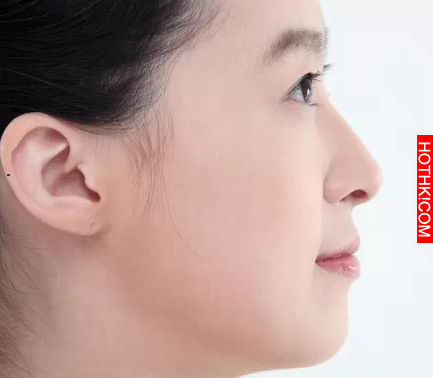 女朋友臉上如果有這七種痣，千萬不要點掉，她是男人一生難得遇見的翻身機會，務必要立 ...