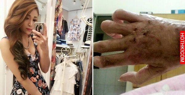 台灣美女在去年泰國爆炸重傷，如今出院竟然變這樣...好讓人心疼！ ...