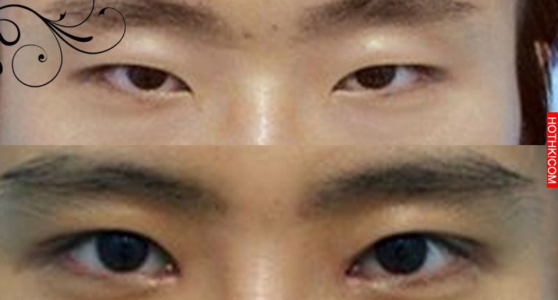 從「眼皮」就能看出一個人會不會「出軌」！！上眼皮下垂的男人，是不可多得的好男人， ...