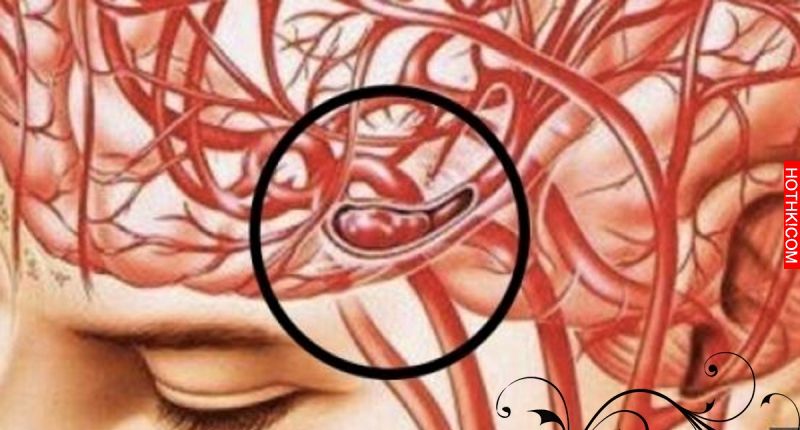 如果你突然常打哈欠、頭痛、頭暈，那就要特別小心了！！可能是大病前兆！！ ...