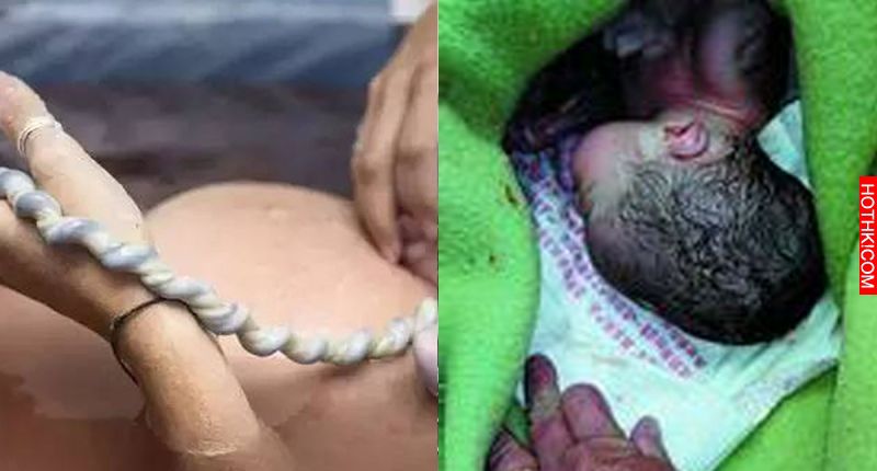 生出孩子、剪斷臍帶的那瞬間，產婦突然一聲咳嗽！沒想到最後竟然.... ...