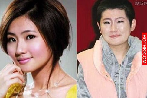 Selina燒傷前後照片對比，事發後她與「張承中」都是分房睡...沒想到阿中最後竟然... ...